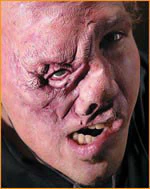 Reel F/X Igor Prosthetic