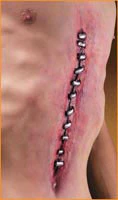 Reel F/X Malpractice Prosthetic