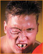 Reel F/X Shiner Prosthetic