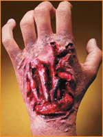 Reel F/X Torn Up Hand Prosthetic